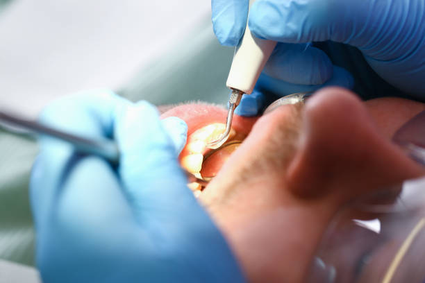 Best Urgent Care for Lost Fillings or Crowns in Sulphur Springs, AR